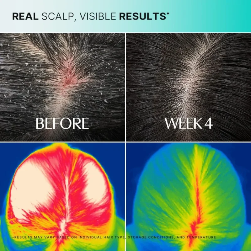 سرم اسکالپ Cica PDRN لیلیوئه SCALP حجم ۱۰۰ میلی‌لیتر - تصویر 7